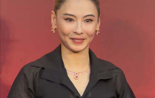 45岁张柏芝“神颜”崩了？脸部浮肿苹果肌凸出，网友吐槽医美过度