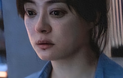 钱再多有什么用？43岁孙俪眼球血管破裂，给所有中年女人提了个醒 
