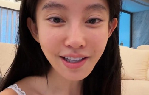 冯提莫首度承认整容：泪沟填充、做双眼皮，提醒大家变美有风险