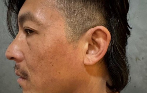 这是陈冠希？近照憔悴邋遢，和同龄男神差距太大