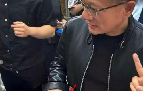 全网围观AI教父黄仁勋的指甲！医生：6种情况都可能