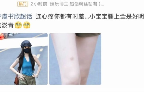 虞书欣膝盖受伤会影响《长生骨》拍摄进度吗？
