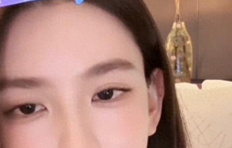 孙一宁曝医美内幕：那些“打针变美”视频，都是靠美颜P图出来的 